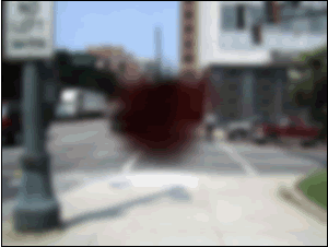 Central field loss - image is blurry and the center is blacked out
